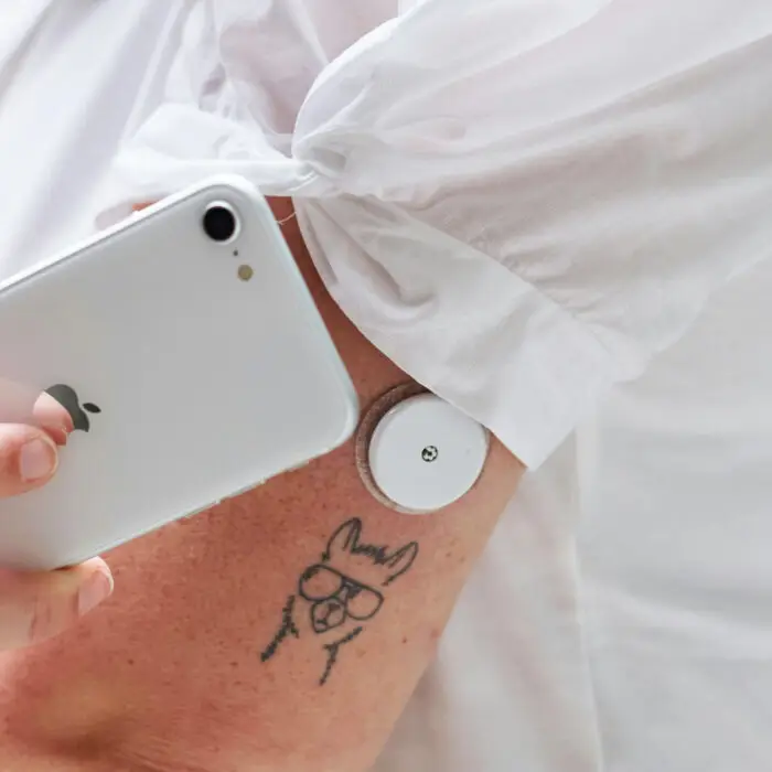 Blood sugar monitor on the arm