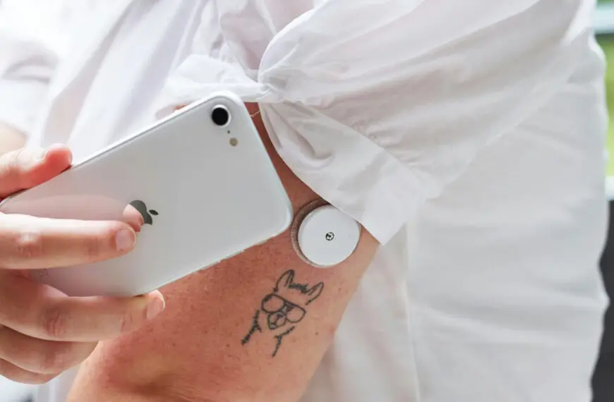 Blood sugar monitor on the arm